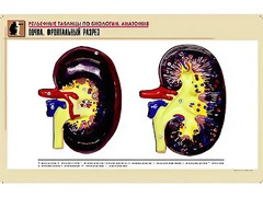 Рельефная таблица "Почка. Фронтальный разрез" (формат А1, матовое ламинирование) - fgospostavki.ru - Казань