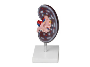 Модель почки в разрезе - fgospostavki.ru - Казань