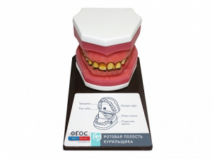 Демонстрационная модель "Ротовая полость курильщика" - fgospostavki.ru - Казань