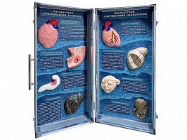 Учебно-демонстрационный кейс "Последствия употребления алкоголя и наркотиков" - fgospostavki.ru - Казань